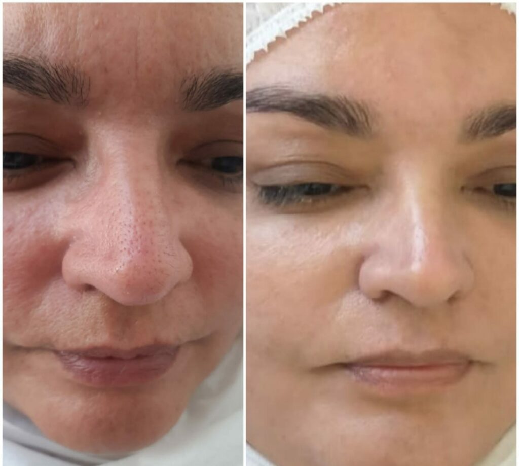 WhatsApp Image 2024-06-20 at 16.02.35