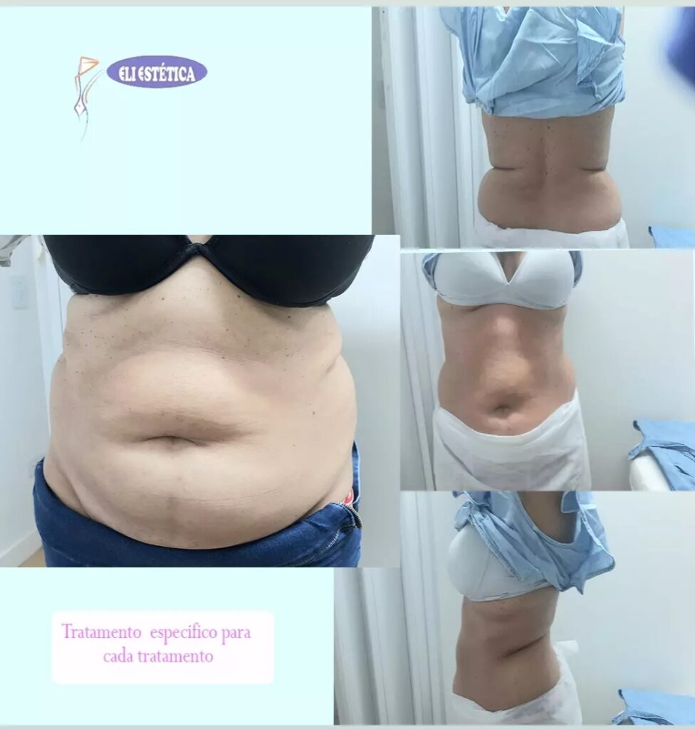 WhatsApp Image 2024-06-20 at 16.06.58